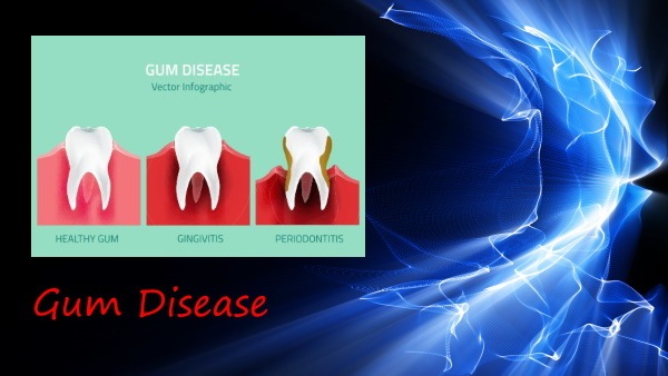 Gum Disease